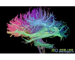 人体构造最新医学成像技术,透视奇妙人体构造